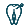 endodonzia