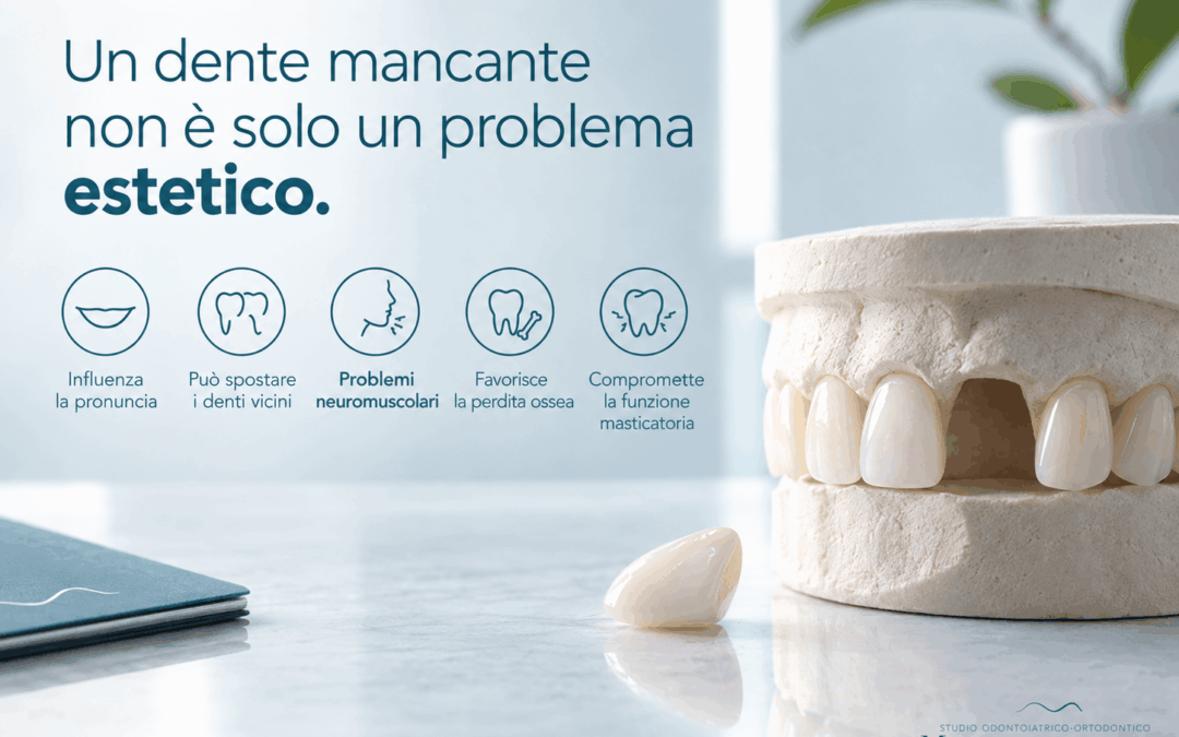 Salute orale, denti mancanti da non sottovalutare